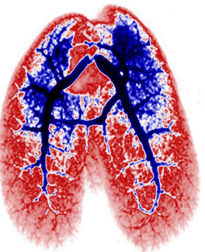 Imaging of a set of lungs