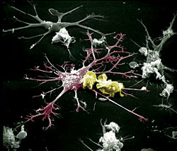 Dendritic cells (Photo courtesy of William Bowers)