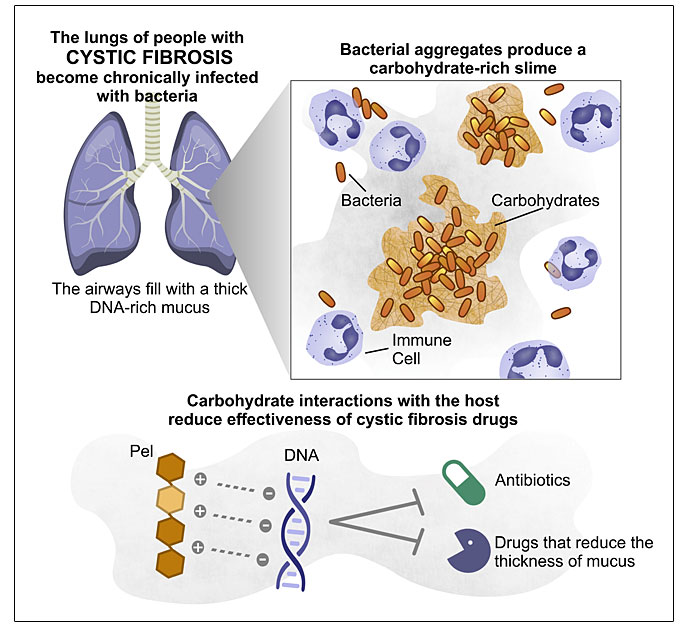 This graphic shows how bacteria attack the lungs of people with cystic fibrosis by creating a slime that reduces the effectiveness of drugs.