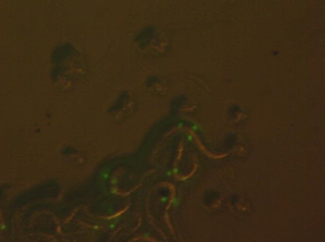 C. elegans or nematodes with fluorescent green glowing dopamine neurons image from microscope.